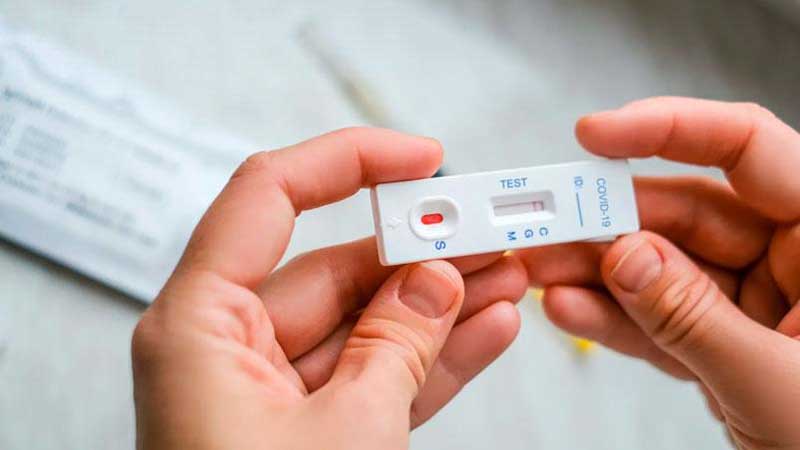 Coronavirus: La ANMAT autorizó la venta de un nuevo autotest COVID-19