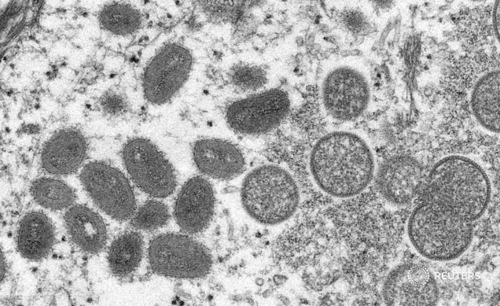 América registra casi un tercio del total mundial de los casos de viruela del mono