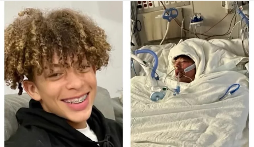 Insólito: Realizó un desafío viral en TikTok y terminó con el 80 por ciento de su cuerpo quemado