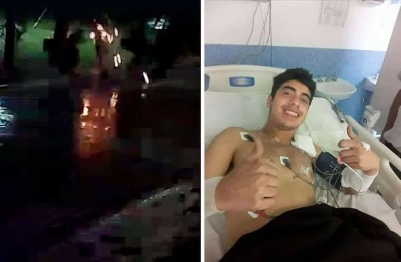 Video impactante: Un rayo cayó sobre un hombre en San Luis y le quemó el 20% del cuerpo