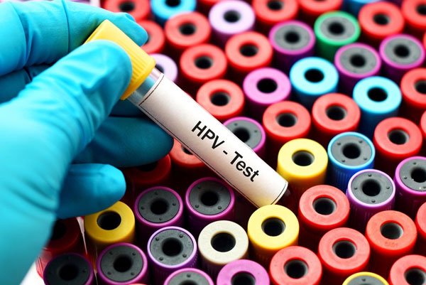 Más de 300 afiliadas a Seros ya solicitaron el autotest de VPH