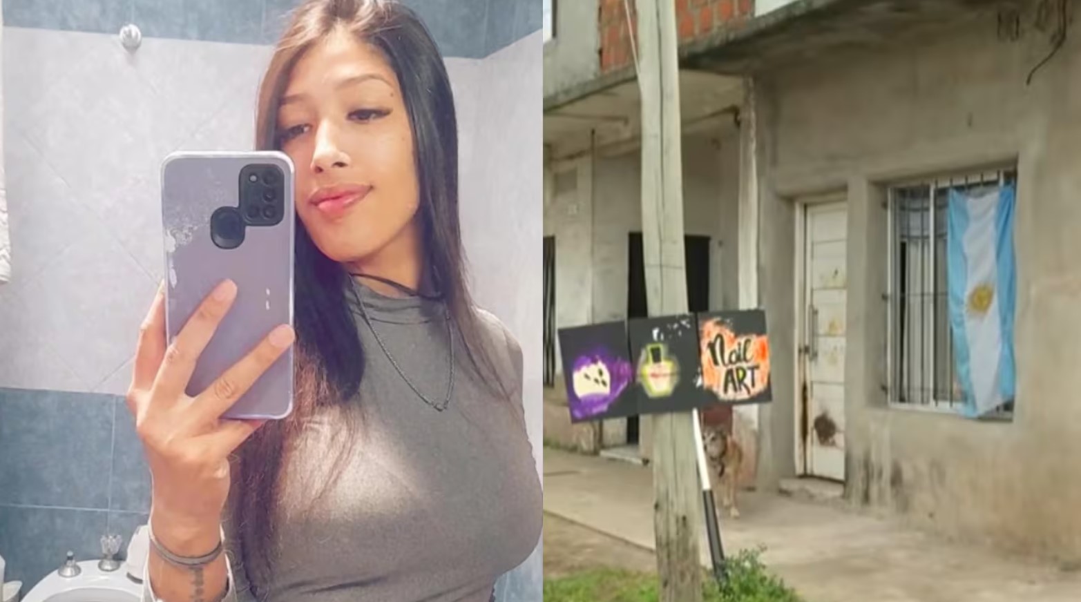 La hermana de la joven atacada con ácido en Tres de Febrero y un pedido desesperado: “Necesitamos saber quién fue”